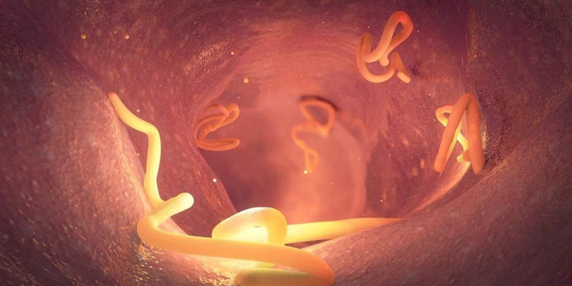 Kasus Cacingan Menurun, Kemenkes Ingatkan Bahaya Infeksi Berulang