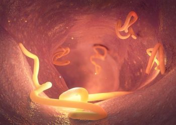 Kasus Cacingan Menurun, Kemenkes Ingatkan Bahaya Infeksi Berulang