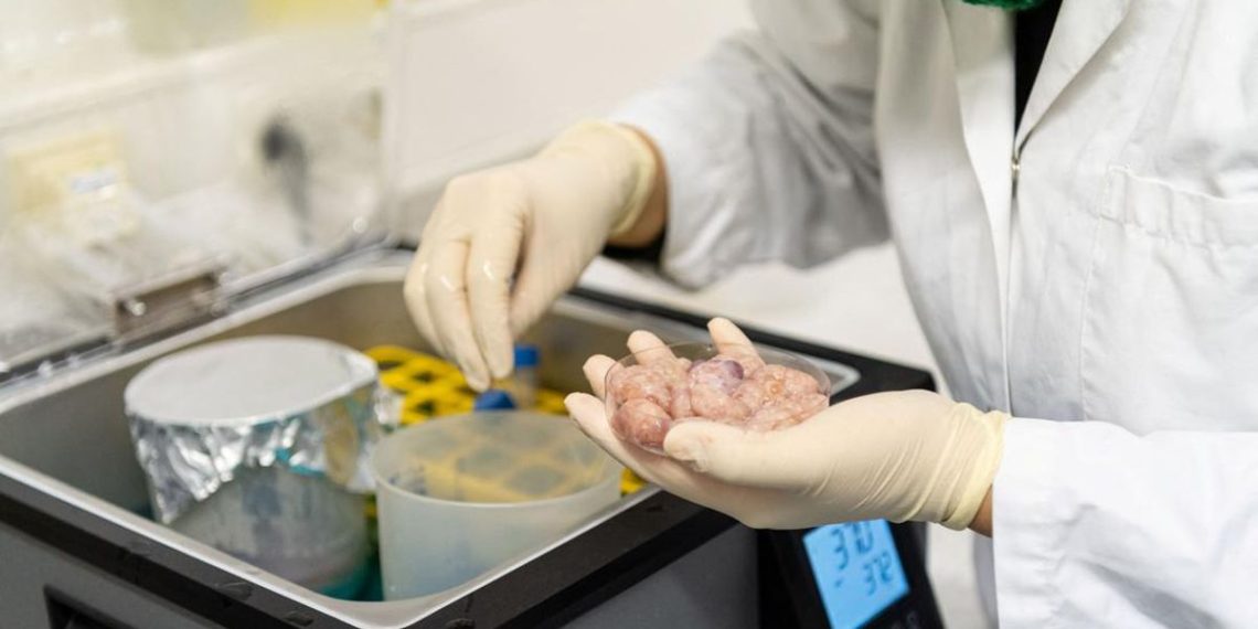 Donor Organ dalam Perspektif Islam: Apakah Diperbolehkan?