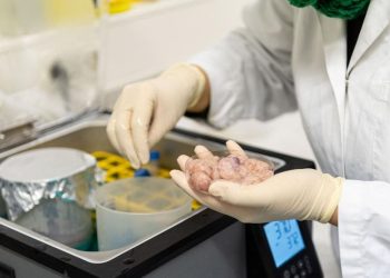 Donor Organ dalam Perspektif Islam: Apakah Diperbolehkan?