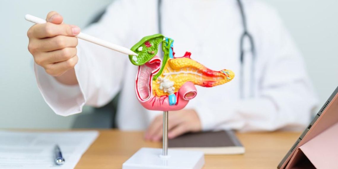 6 Makanan Ampuh Hancurkan Batu Empedu yang Perlu Diketahui