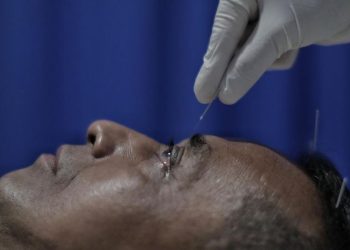 Manfaat Terapi Akupunktur Medis yang Perlu Diketahui