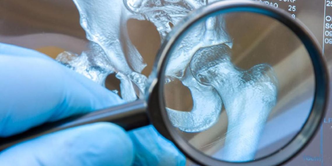 4 Minuman Penyebab Asam Urat yang Sering Dianggap Sehat