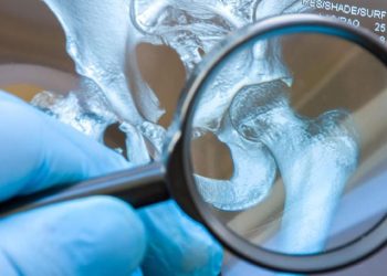 4 Minuman Penyebab Asam Urat yang Sering Dianggap Sehat