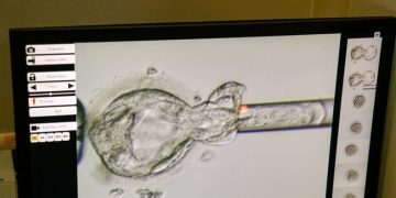 Rekor Dunia, Bayi Lahir dari Embrio Beku Selama 31 Tahun