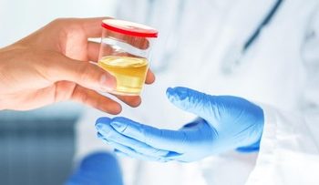 Ciri-ciri Penyakit Ginjal dari Air Kencing yang Perlu Diketahui