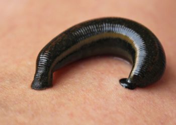 Mimisan Berhari-hari, Lintah Ditemukan Bersarang di Hidung Pria